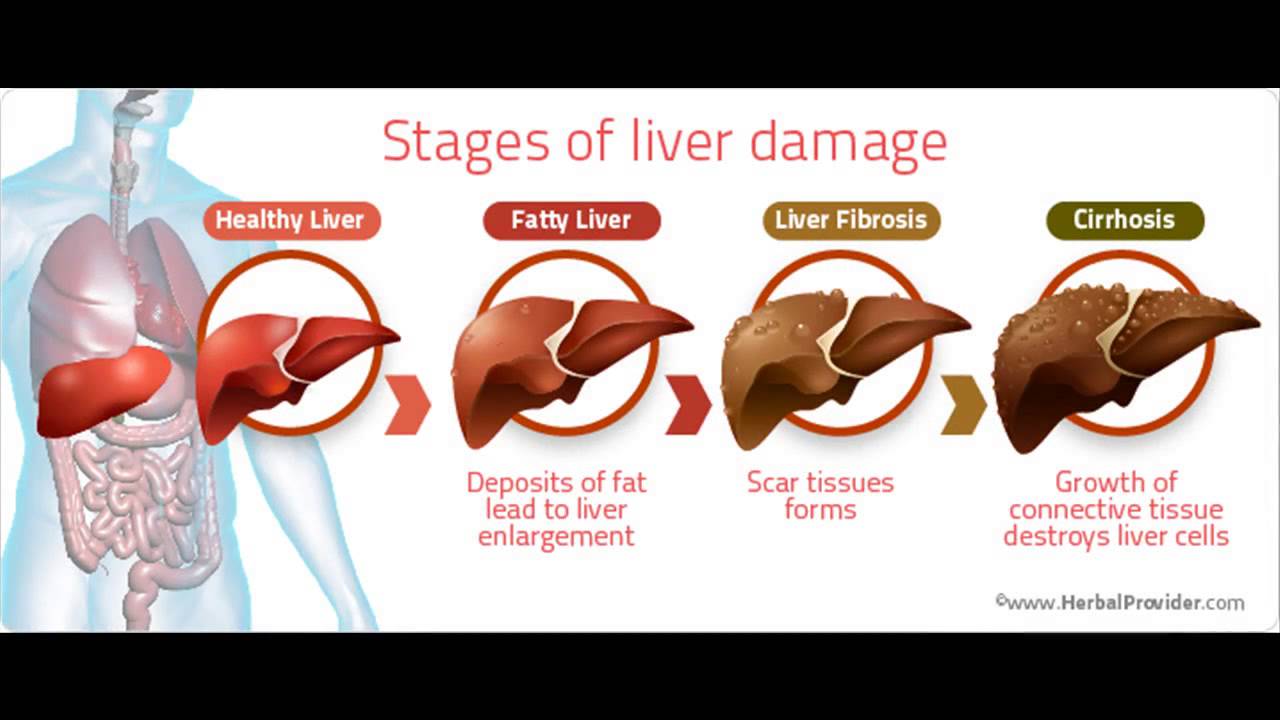 youtube fatty liver
